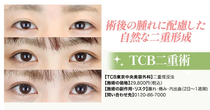 TCB東京中央美容外科のコースのおすすめなポイント1