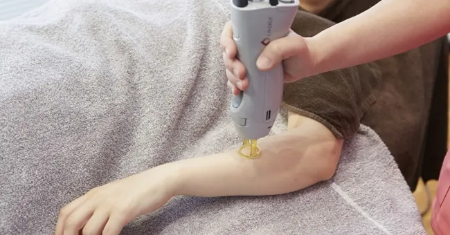 わかさクリニックのまつ毛貧毛症コースのおすすめなポイント2