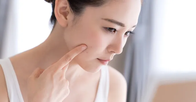 Wi CLINIC(ウィクリニック)の美肌・ニキビ・ハリツヤコースのおすすめなポイント1