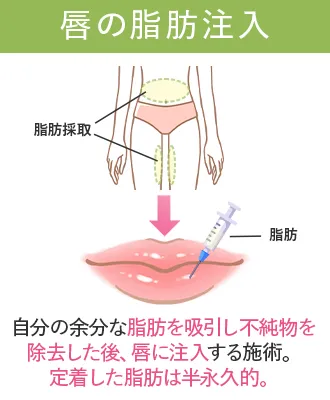 鼻整形おすすめクリニック