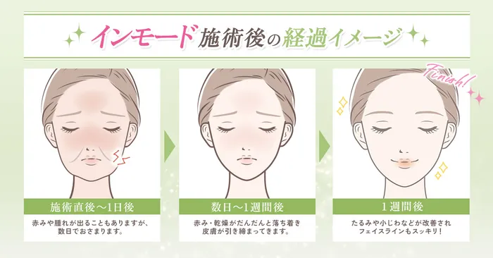 ダウンタイム