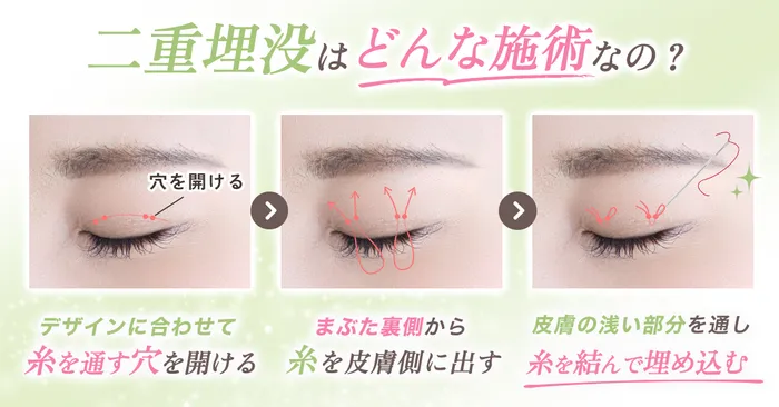 【最新】二重埋没でぱっちり二重に！口コミや上手い先生で評判の大手クリニック12院を徹底比較
