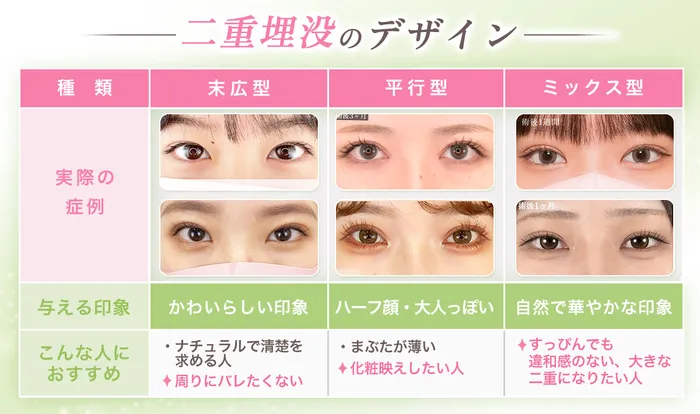 【最新】二重埋没でぱっちり二重に！口コミや上手い先生で評判の大手クリニック12院を徹底比較