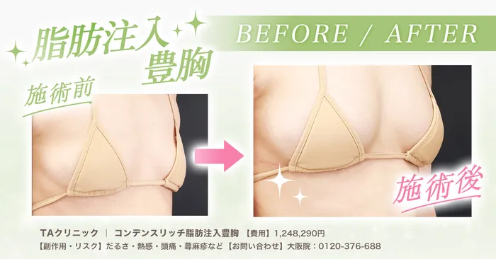 【必見】豊胸したら後悔するって本当？デメリットも合わせておすすめの豊胸術を徹底調査