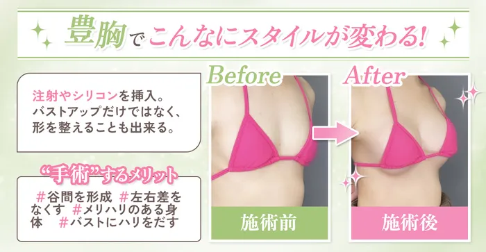 【必見】豊胸したら後悔するって本当？デメリットも合わせておすすめの豊胸術を徹底調査