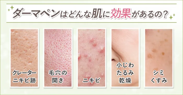 効果がある肌一覧