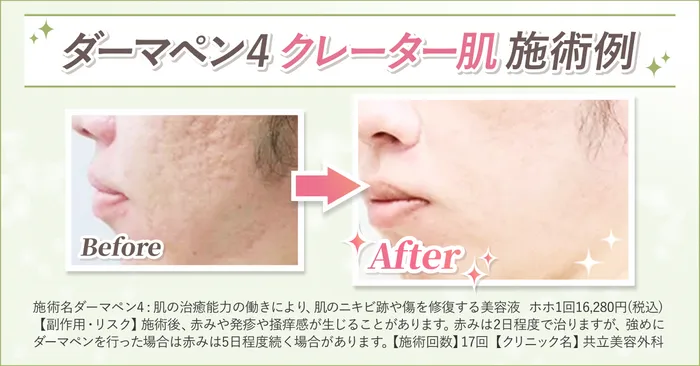 ビフォーアフター