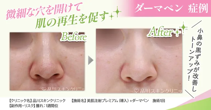 ビフォーアフター