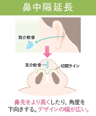 鼻整形おすすめクリニック