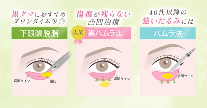 目の下のたるみ取り施術件数の推移