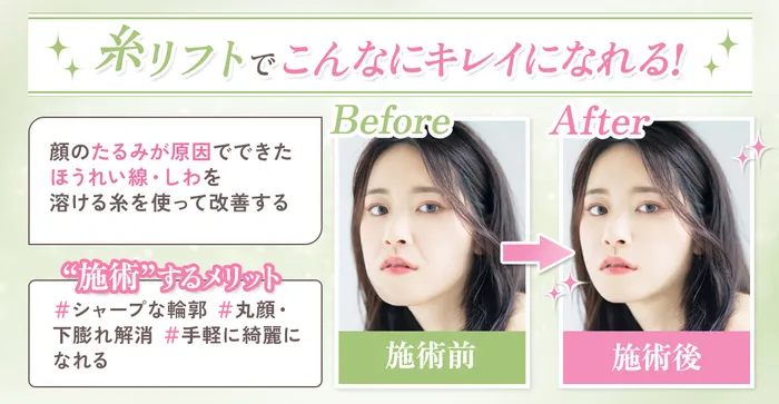 糸リフトの効果を実感する女性