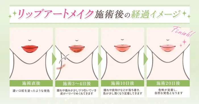 【徹底比較】1番安くアートメイクを受けられるおすすめのクリニックはどこ？痛みやダウンタイムの経過と合わせて徹底調査