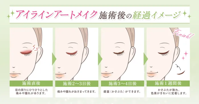 【徹底比較】1番安くアートメイクを受けられるおすすめのクリニックはどこ？痛みやダウンタイムの経過と合わせて徹底調査