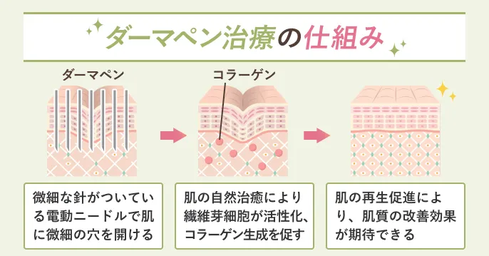 10社の調査をもとに、ダーマペンの値段の相場がまるわかり！オプションメニューの値段も解説