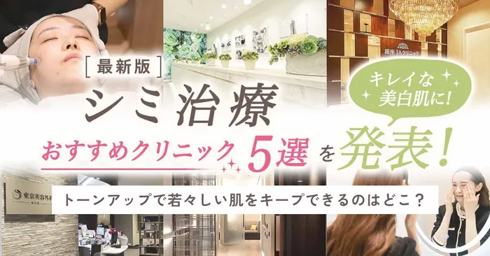 【ピコレーザー】短期間で気になるシミをスッキリ除去！美容皮膚科のシミ取りレーザーがおすすめな理由とは