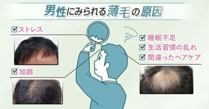クリニックで処方されるAGA治療のセット