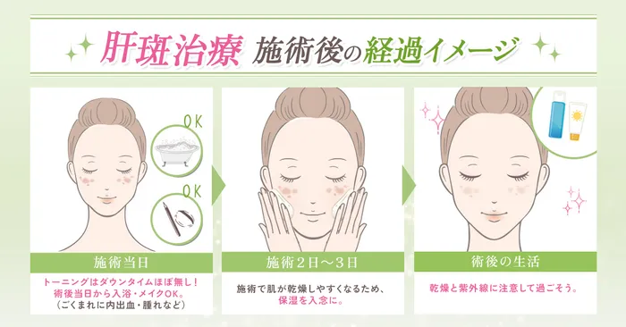 肝斑BA