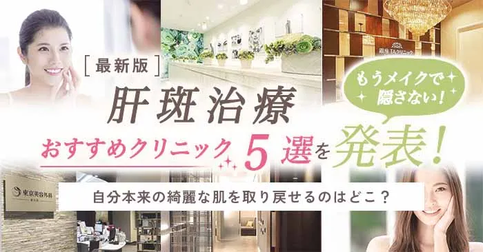 肝斑治療のおすすめクリニック5選