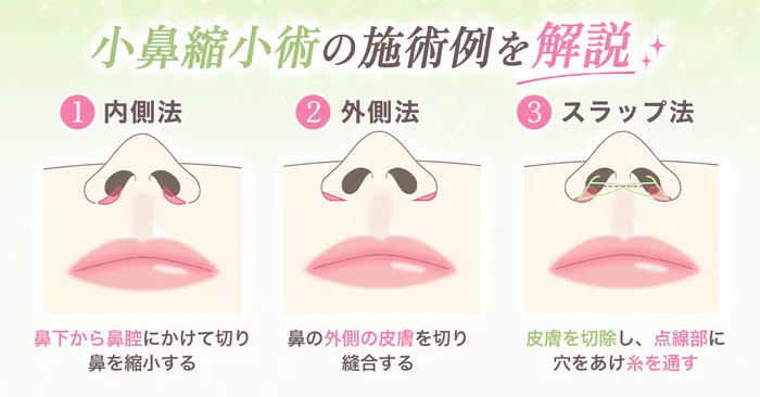 ロジック