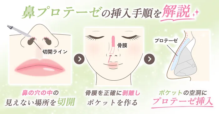 ロジック