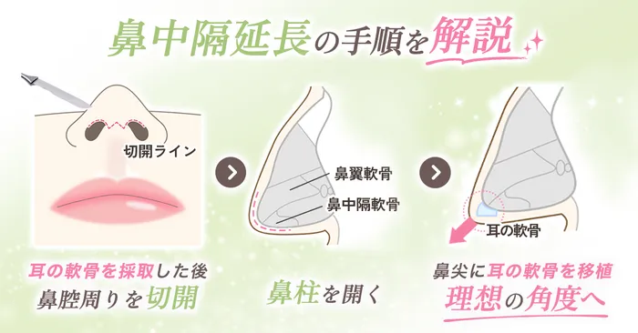 ロジック