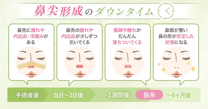 ダウンタイム