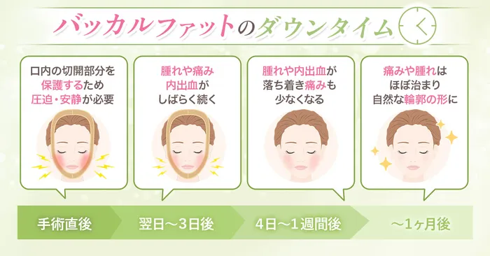 ダウンタイム