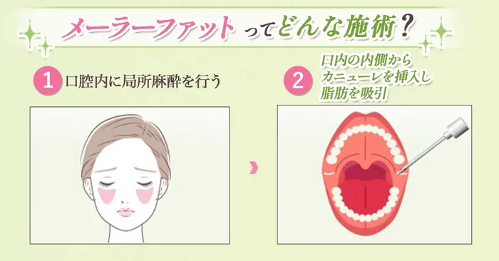 メーラーファット仕組み化