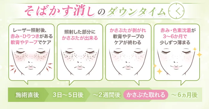 シミ取りレーザーのメリットについてのアンケート結果