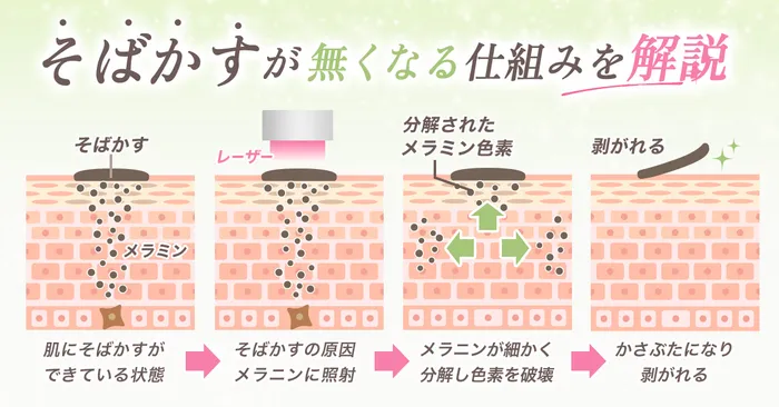 ピコレーザーでシミが消える仕組み