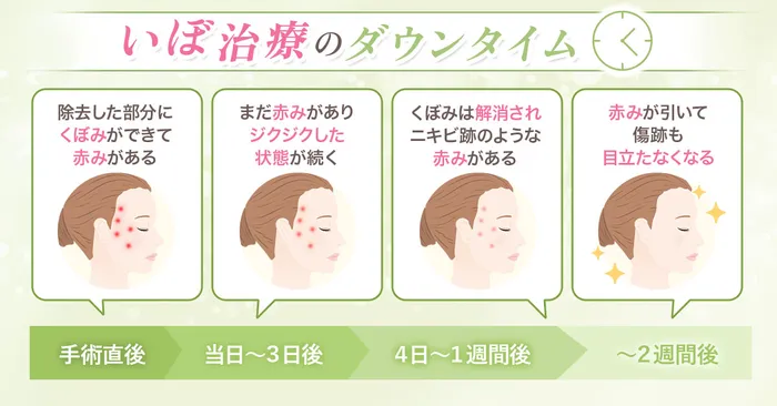 ロジック