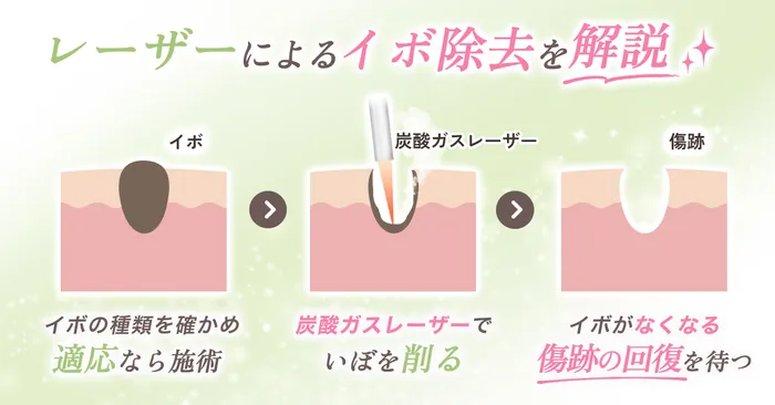 ロジック