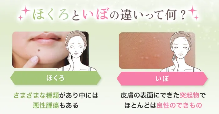 ロジック