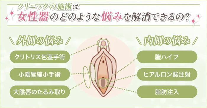 クリニックの婦人科形成で解消できるお悩み一覧