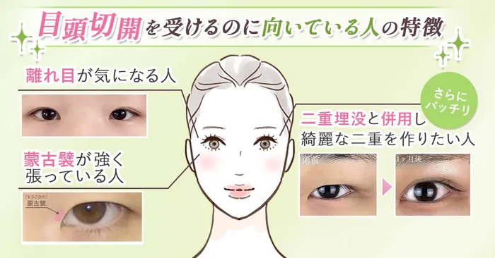 【目頭切開のデメリットは？】蒙古襞が気になる人におすすめ！ビフォーアフターも合わせて紹介