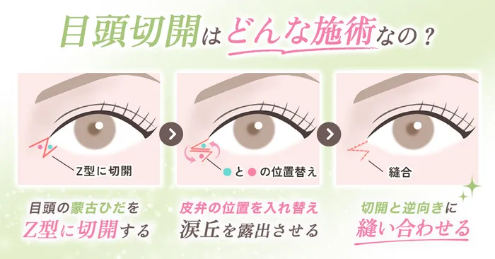 ロジック