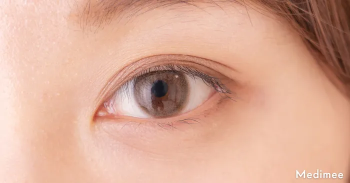 【目頭切開について徹底解説】必要ない・向いていない人の特徴