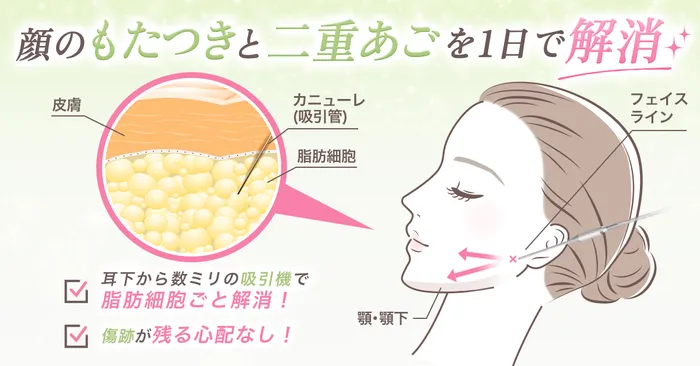 施術内容