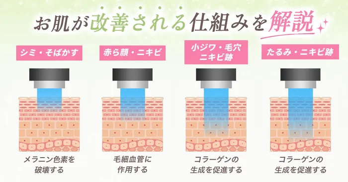 フォトフェイシャルの仕組み