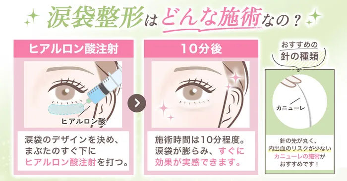 【必見】涙袋のヒアルロン酸はダウンタイムがある？仕上がりのデザインから上手な先生まで徹底調査！
