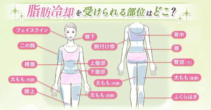 脂肪冷却で部分痩せを実現！