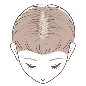 【女性専門】薄毛AGA治療おすすめクリニック5選！女性の薄毛を確実に治す方法とは