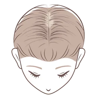 【女性専門】薄毛AGA治療おすすめクリニック5選！女性の薄毛を確実に治す方法とは