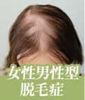 効果抜群】クリニックで行う女性の薄毛治療の効果とは？おすすめのFAGA専門クリニックも紹介