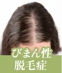 効果抜群】クリニックで行う女性の薄毛治療の効果とは？おすすめのFAGA専門クリニックも紹介