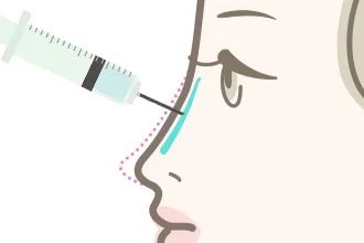 “【必見】鼻のヒアルロン酸はダウンタイムがある？仕上がりのデザインから上手な先生まで徹底調査！”