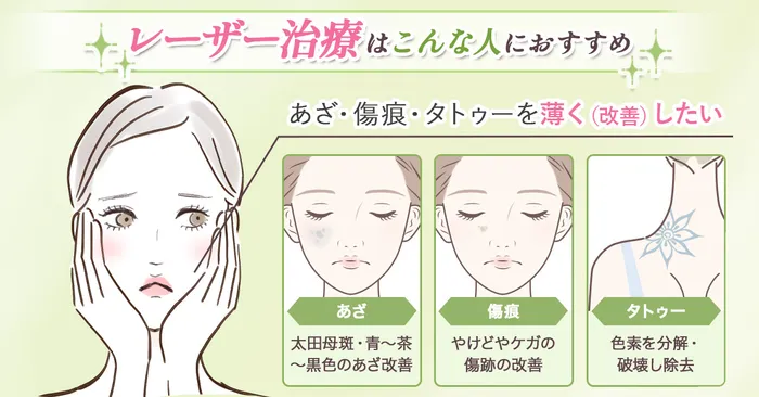 おすすめのタトゥー除去クリニック