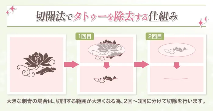 切開法のロジック