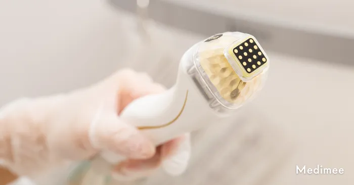 ポテンツァのダイヤモンドチップとは？効果や値段・ダウンタイムを徹底解説！