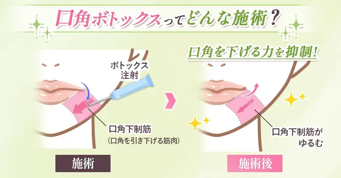 二重埋没h2下画像